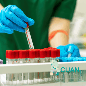 Antígeno Prostático Total y Libre